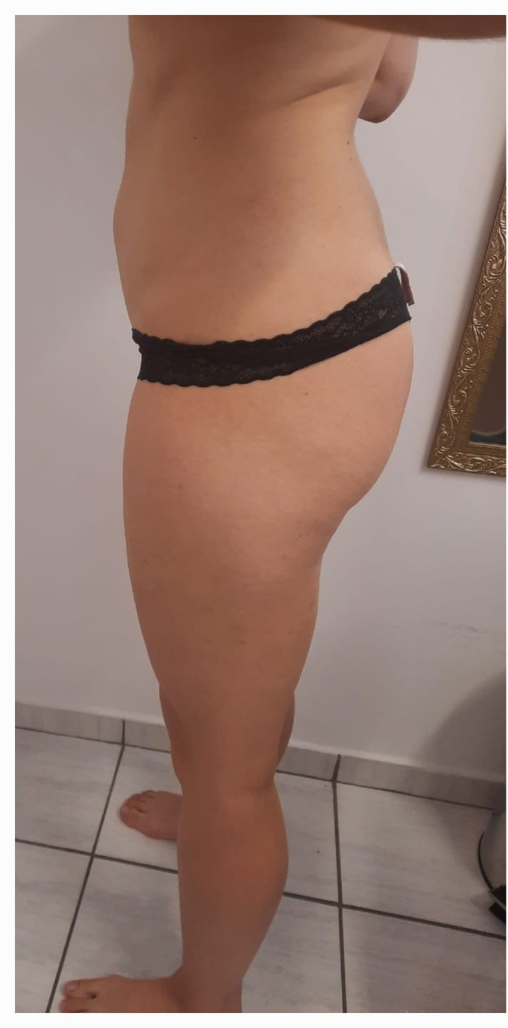 Antes do protocolo corporal