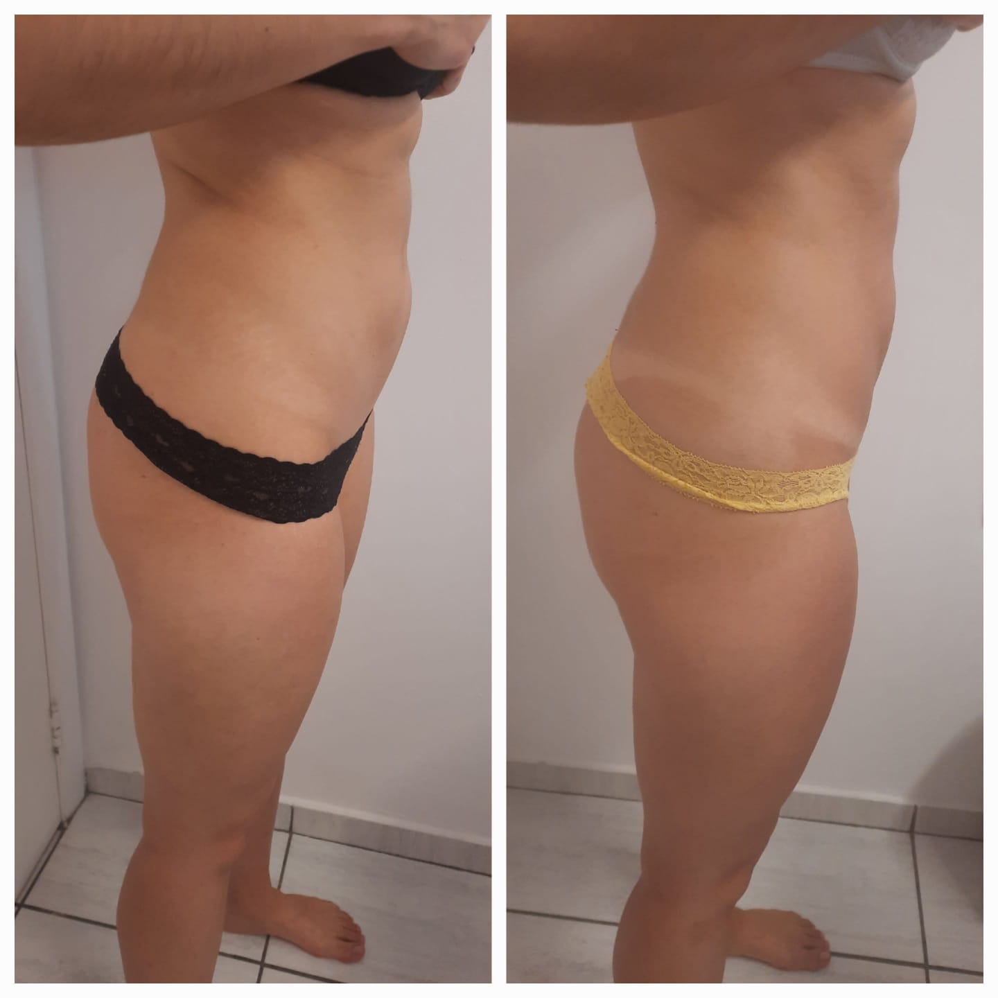 Antes e depois de modelagem corporal